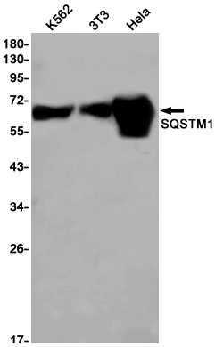 Rabbit Monoclonal Antibody to SQSTM1/p62