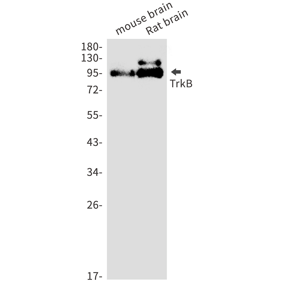 Rabbit Monoclonal Antibody to Trk B