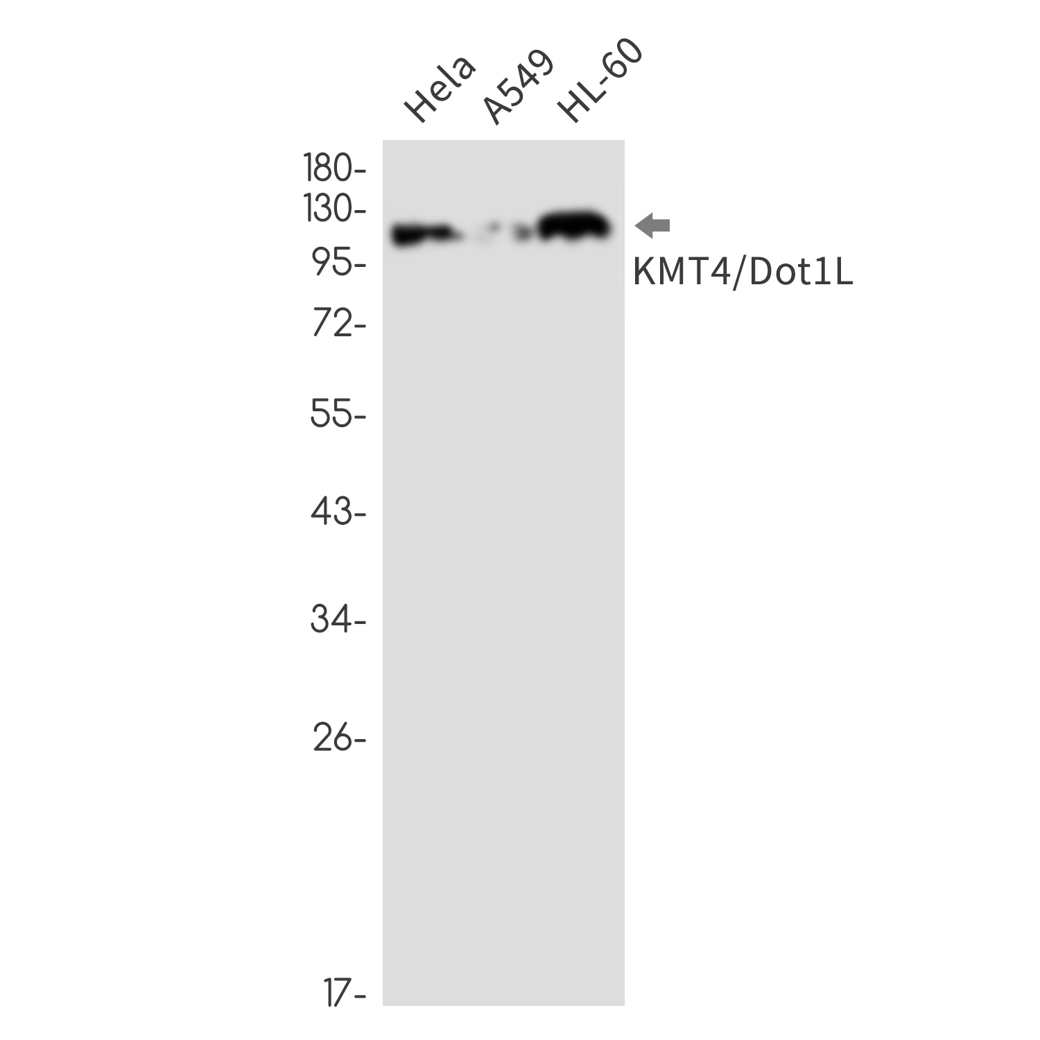 Rabbit Monoclonal Antibody to KMT4