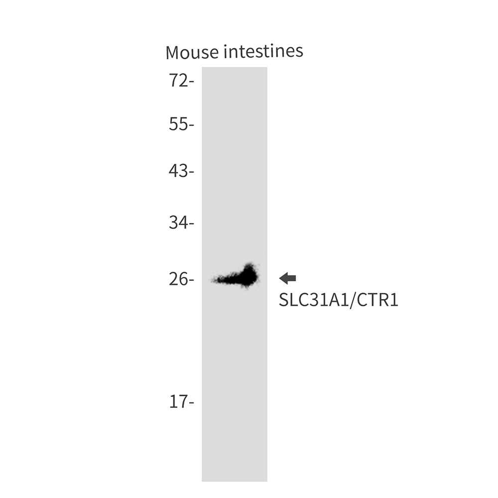 Rabbit Monoclonal Antibody to SLC31A1