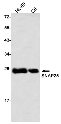 Rabbit Monoclonal Antibody to SNAP25