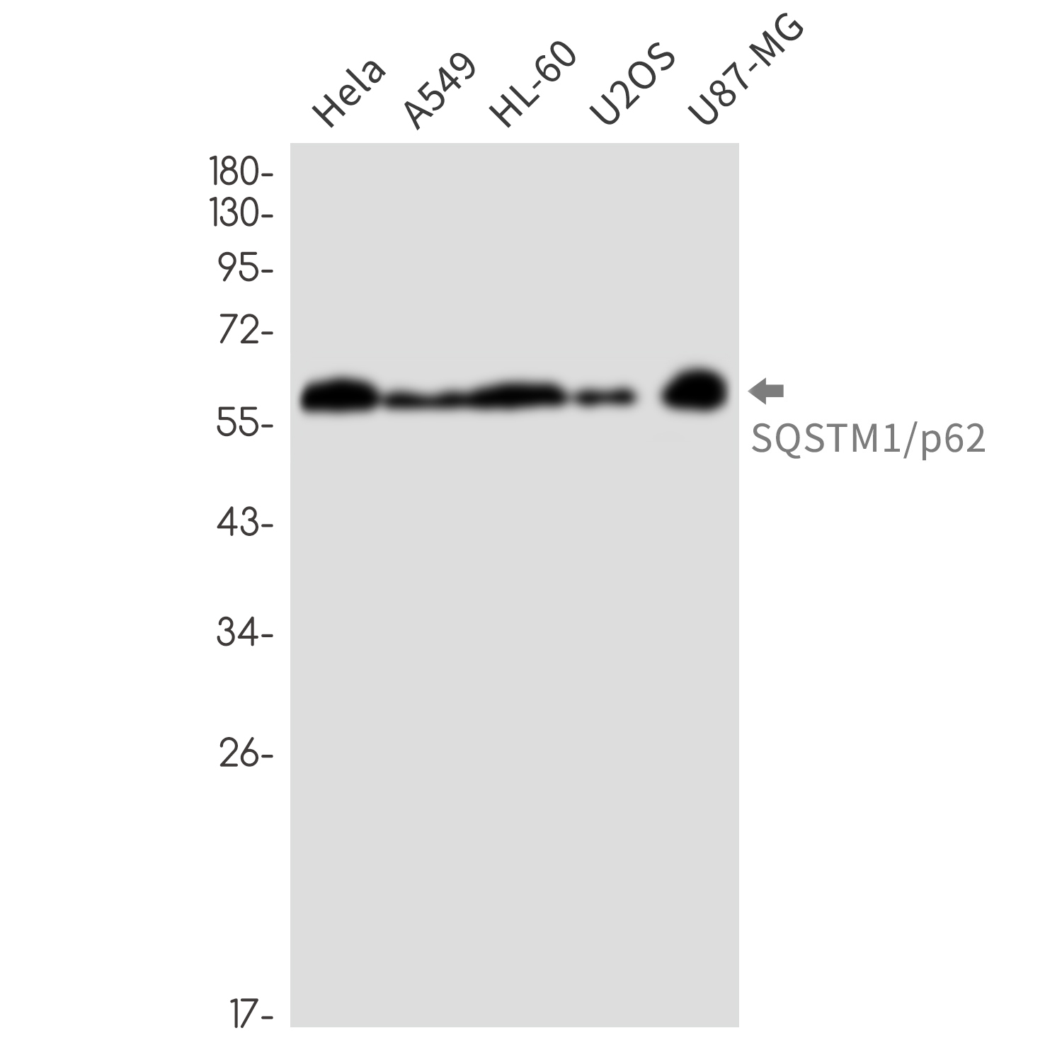 Rabbit Monoclonal Antibody to SQSTM1/p62