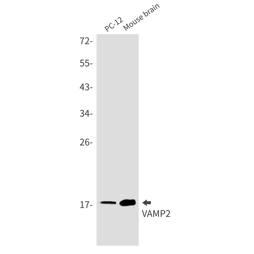 Rabbit Monoclonal Antibody to VAMP2