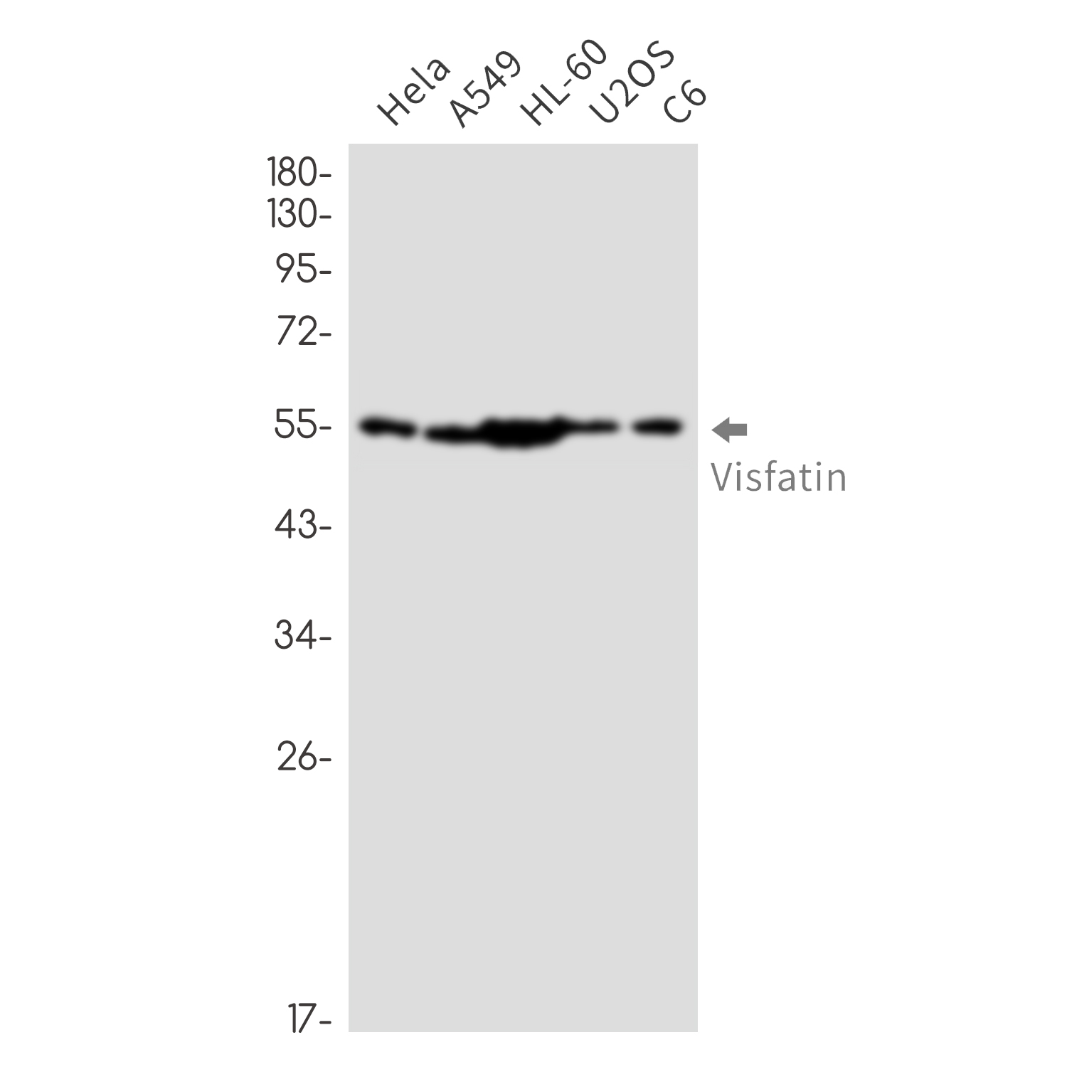 Rabbit Monoclonal Antibody to Nampt