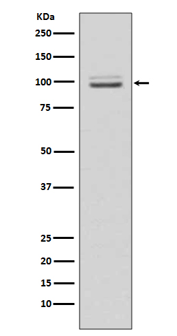 Rabbit Polyclonal Antibody to MKLP1