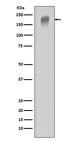 Rabbit Polyclonal Antibody to VEGF Receptor 1