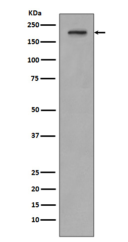 Rabbit Polyclonal Antibody to PDGFR beta