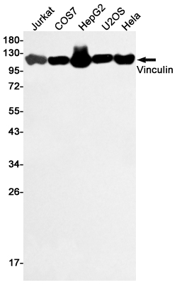 Rabbit Polyclonal Antibody to Vinculin