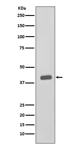Rabbit Polyclonal Antibody to CKII alpha