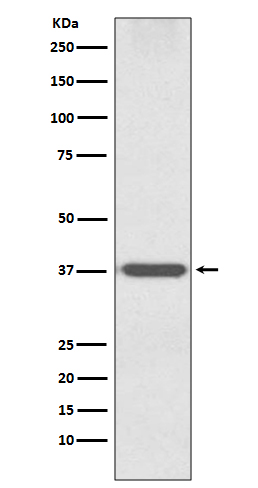 Rabbit Polyclonal Antibody to OTX1