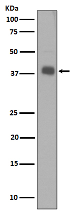 Rabbit Polyclonal Antibody to Synaptophysin
