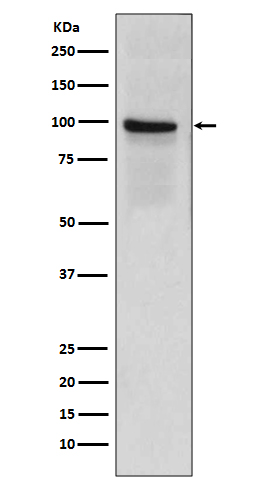 Rabbit Polyclonal Antibody to Thrombomodulin
