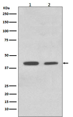 Rabbit Polyclonal Antibody to ACADM
