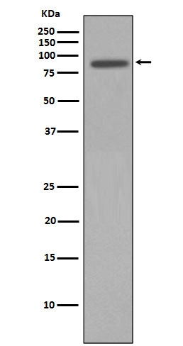 Rabbit Polyclonal Antibody to Nibrin