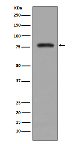 Rabbit Polyclonal Antibody to PKC beta 2