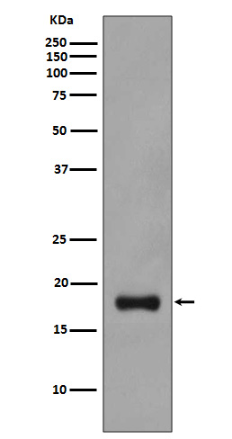 Rabbit Polyclonal Antibody to Stathmin 1