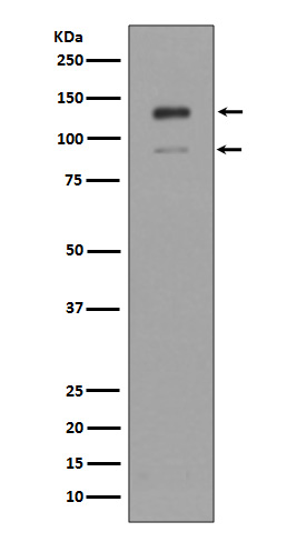 Rabbit Polyclonal Antibody to Interferon alpha/beta Receptor 1