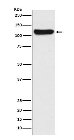 Rabbit Polyclonal Antibody to FAK