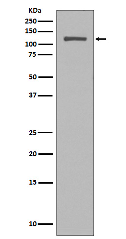 Rabbit Polyclonal Antibody to NUP98