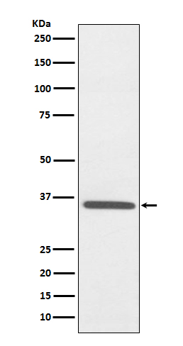 Rabbit Polyclonal Antibody to Fibrillarin