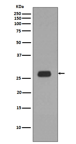 Rabbit Polyclonal Antibody to Prohibitin