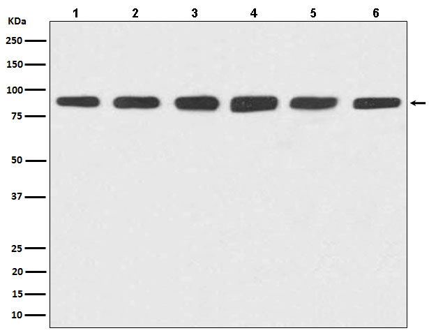 Rabbit Polyclonal Antibody to Hsp90 alpha/beta