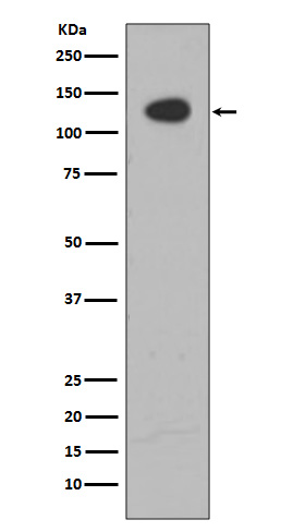 Rabbit Polyclonal Antibody to ATP Citrate lyase