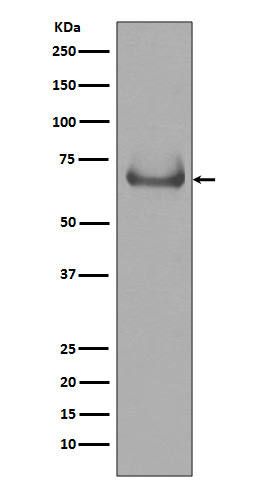 Rabbit Polyclonal Antibody to Lamin B Receptor