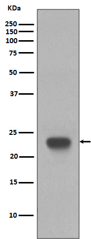 Rabbit Polyclonal Antibody to CD3 epsilon