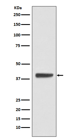 Rabbit Polyclonal Antibody to Islet 1
