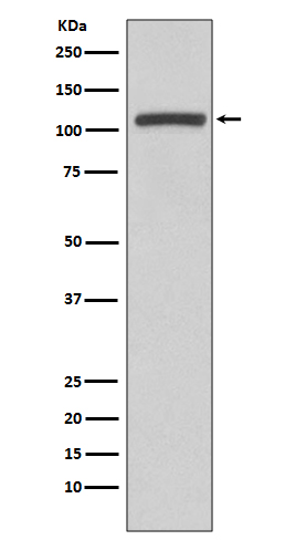 Rabbit Polyclonal Antibody to PI3 Kinase p110 beta