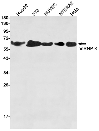 Rabbit Polyclonal Antibody to hnRNP K