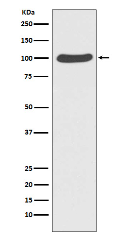 Rabbit Polyclonal Antibody to CTNNA1