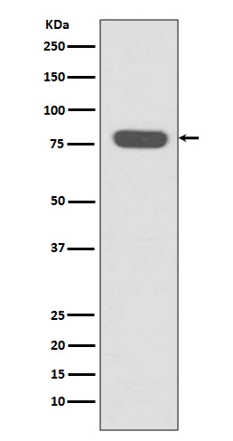 Rabbit Polyclonal Antibody to Radixin