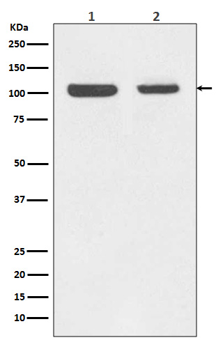 Rabbit Polyclonal Antibody to Rb