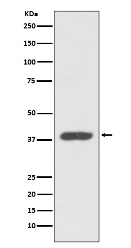 Rabbit Polyclonal Antibody to RDC1
