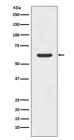 Rabbit Polyclonal Antibody to Asparagine Synthetase