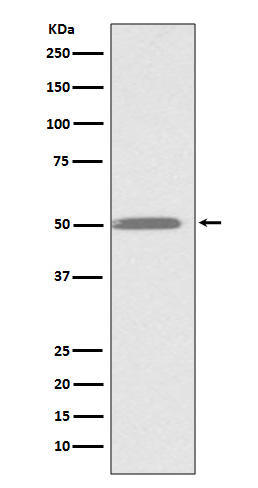 Rabbit Polyclonal Antibody to Integrin Linked ILK