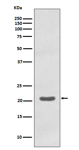 Rabbit Polyclonal Antibody to MTCO2