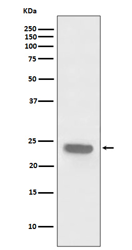 Rabbit Polyclonal Antibody to PARK7/DJ1