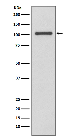 Rabbit Polyclonal Antibody to INPP4B