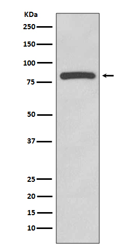 Rabbit Polyclonal Antibody to Glycogen Synthase 1