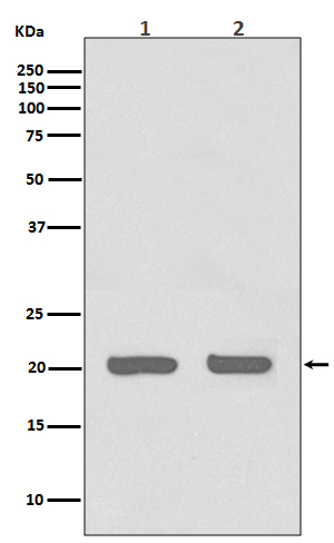 Rabbit Polyclonal Antibody to IL-1 Receptor Antagonist Protein
