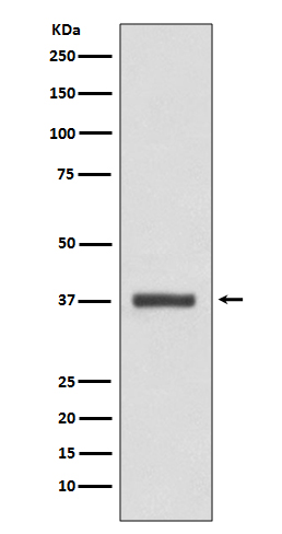 Rabbit Polyclonal Antibody to CDK6