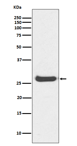 Rabbit Polyclonal Antibody to Histone H1.0