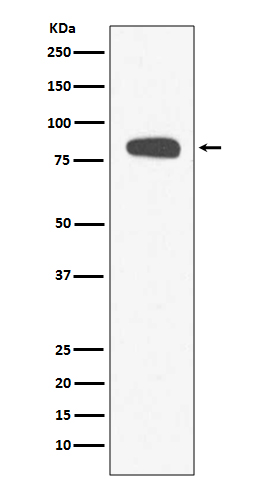 Rabbit Polyclonal Antibody to Stromal Interaction Molecule 1