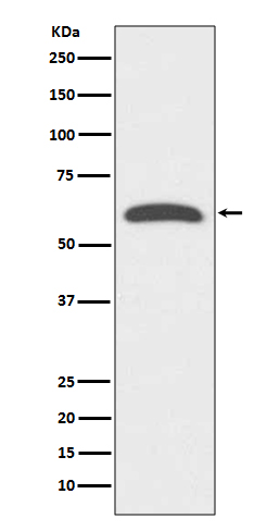 Rabbit Polyclonal Antibody to FOXO4