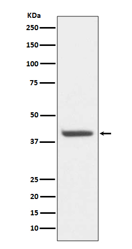 Rabbit Polyclonal Antibody to HDAC8