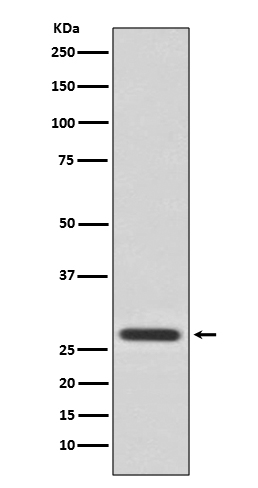 Rabbit Polyclonal Antibody to 14-3-3 theta