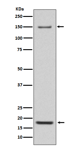 Rabbit Polyclonal Antibody to Integrin alpha 5
